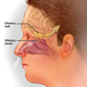 Illustration for article titled Can we stop the spread of brain-eating amoebas that killed two children in Minnesota?